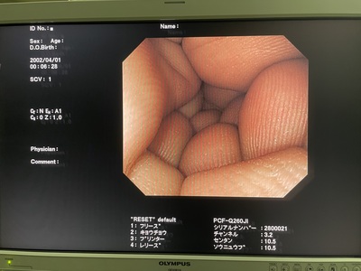 Colonoscope&nbsp;|&nbsp;OLYMPUS&nbsp;|&nbsp;PCF-Q260JI