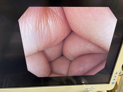 Video Gastroscope&nbsp;|&nbsp;OLYMPUS&nbsp;|&nbsp;GIF-H260Z