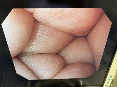 Video Gastroscope&nbsp;|&nbsp;OLYMPUS&nbsp;|&nbsp;GIF-PQ260