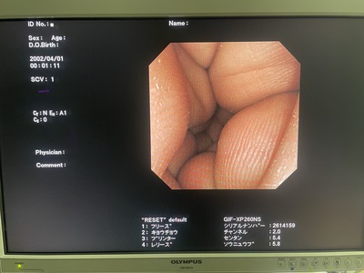 Video Gastroscope&nbsp;|&nbsp;OLYMPUS&nbsp;|&nbsp;GIF-XP260NS