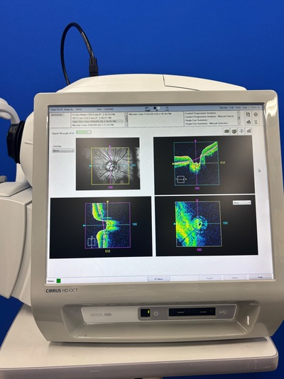 Making high-precision OCT more accessible. A feature-packed model that dramatically elevates the quality of daily clinical practice.&nbsp;|&nbsp;Carl Zeiss&nbsp;|&nbsp;Cirrus 500 HD-OCT Plus