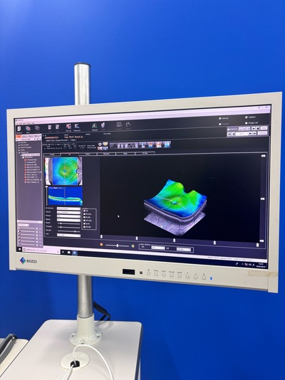 12-megapixel fundus photography × ultra-high-definition OCT&nbsp;|&nbsp;NIDEK&nbsp;|&nbsp;RS-330 Retina Scan Duo