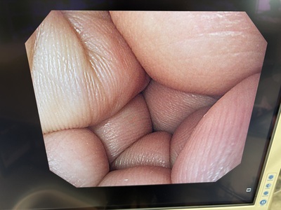Video Gastroscope&nbsp;|&nbsp;OLYMPUS&nbsp;|&nbsp;GIF-H290