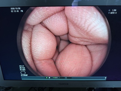 Endoscopy System&nbsp;|&nbsp;FUJIFILM&nbsp;|&nbsp;EPX-4450HD