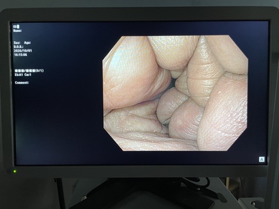 CV-170 + GIFH170 Endoscope Set&nbsp;|&nbsp;OLYMPUS&nbsp;|&nbsp;GIF-H170