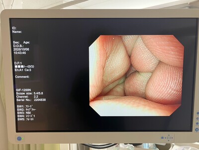 Gastroscope&nbsp;|&nbsp;OLYMPUS&nbsp;|&nbsp;GIF-1200N