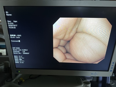 Video Gastroscope&nbsp;|&nbsp;OLYMPUS&nbsp;|&nbsp;GIF-H290