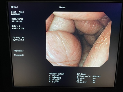 Video Gastroscope&nbsp;|&nbsp;OLYMPUS&nbsp;|&nbsp;GIF-Q260