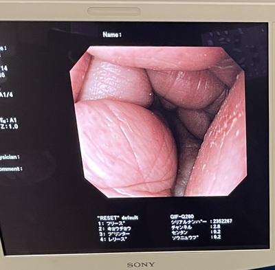 Endoscopy System&nbsp;|&nbsp;OLYMPUS&nbsp;|&nbsp;LUCERA CV-260SL
