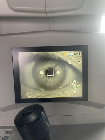 Specular Microscope&nbsp;|&nbsp;TOPCON&nbsp;|&nbsp;SP-3000P
