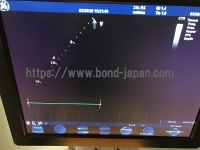 Color Doppler&nbsp;|&nbsp;GE&nbsp;|&nbsp;Vivid S5