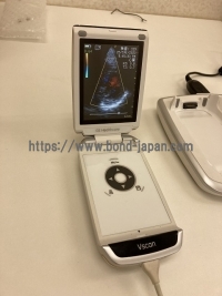 回診用超音波診断装置&nbsp;|&nbsp;GEヘルスケア・ジャパン株式会社&nbsp;|&nbsp;Vscanの写真