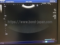 超音波診断装置/カラードプラ&nbsp;|&nbsp;キャノンメディカル株式会社&nbsp;|&nbsp;Aplio 400の写真