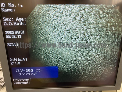 Video Gastroscope&nbsp;|&nbsp;OLYMPUS&nbsp;|&nbsp;GIF-Q260