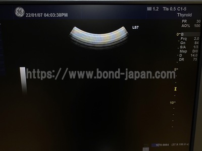 超音波診断装置/カラードプラ&nbsp;|&nbsp;GEヘルスケア・ジャパン株式会社&nbsp;|&nbsp;Logiq S7 Expertの写真
