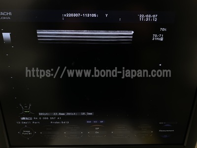 超音波診断装置/カラードプラ&nbsp;|&nbsp;日立製作所&nbsp;|&nbsp;F37の写真
