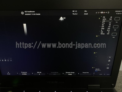 超音波診断装置&nbsp;|&nbsp;GEヘルスケア・ジャパン株式会社&nbsp;|&nbsp;Versana Activeの写真