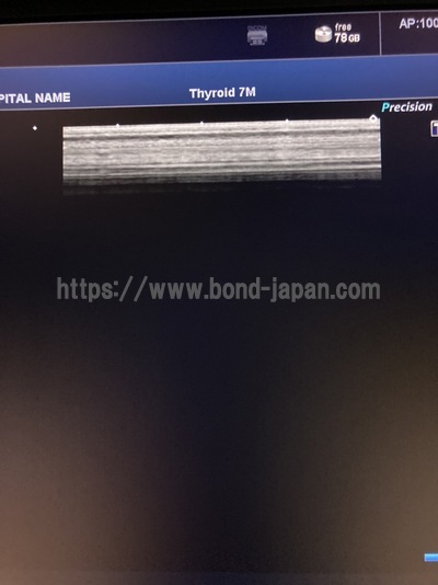 超音波診断装置/カラードプラ&nbsp;|&nbsp;キャノンメディカル株式会社&nbsp;|&nbsp;Xario 200の写真