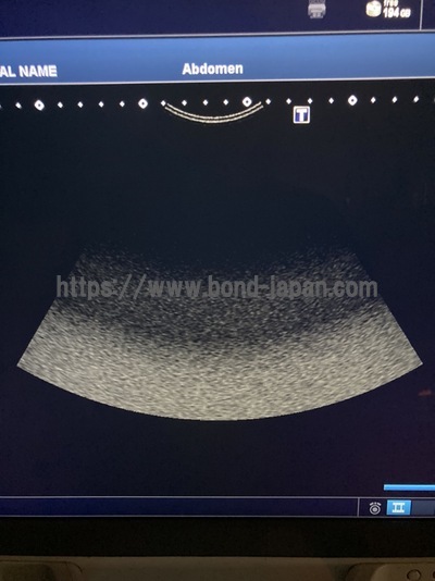 超音波診断装置/カラードプラ&nbsp;|&nbsp;キャノンメディカル株式会社&nbsp;|&nbsp;Aplio 300の写真