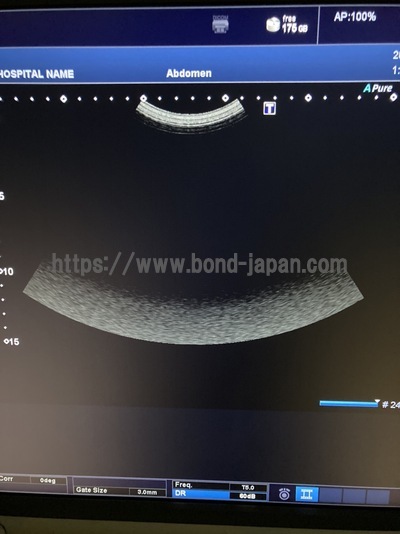 超音波診断装置/カラードプラ&nbsp;|&nbsp;キャノンメディカル株式会社&nbsp;|&nbsp;TUS-X100 Xario 100の写真