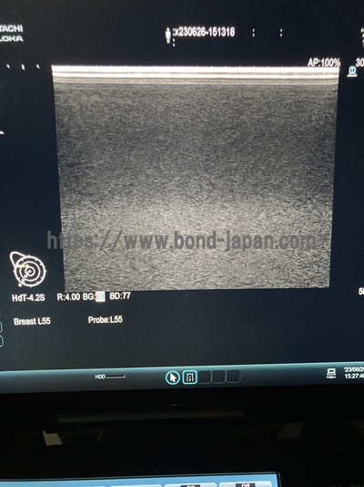 超音波診断装置&nbsp;|&nbsp;日立アロカメディカル株式会社&nbsp;|&nbsp;ARIETTA E70の写真