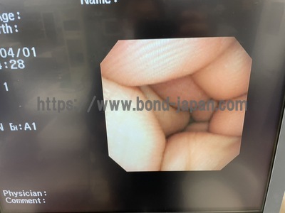 Bronchoscope&nbsp;|&nbsp;OLYMPUS&nbsp;|&nbsp;BF-1T200