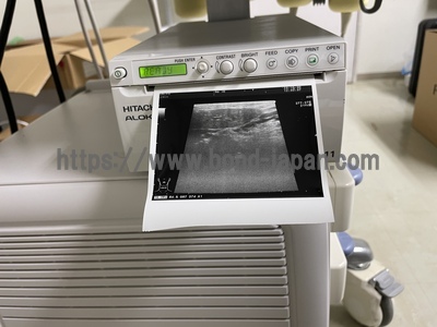 Color Doppler&nbsp;|&nbsp;HITACHI&nbsp;|&nbsp;F37