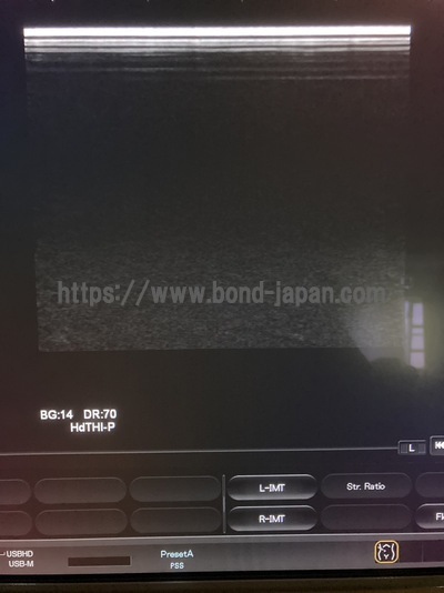 Color Doppler&nbsp;|&nbsp;HITACHI&nbsp;|&nbsp;Hi Vision Preirus