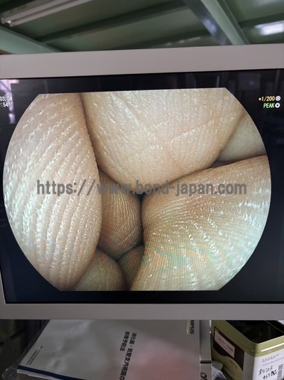 上部消化管経鼻用ビデオスコープ&nbsp;|&nbsp;富士フイルムメディカル株式会社&nbsp;|&nbsp;EG-6400Nの写真