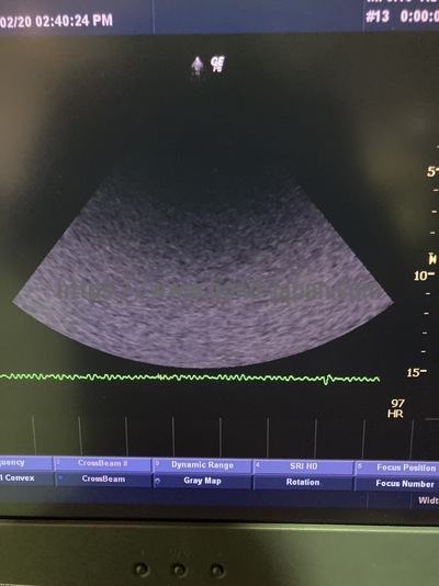 Color Doppler&nbsp;|&nbsp;GE&nbsp;|&nbsp;LOGIQ P6