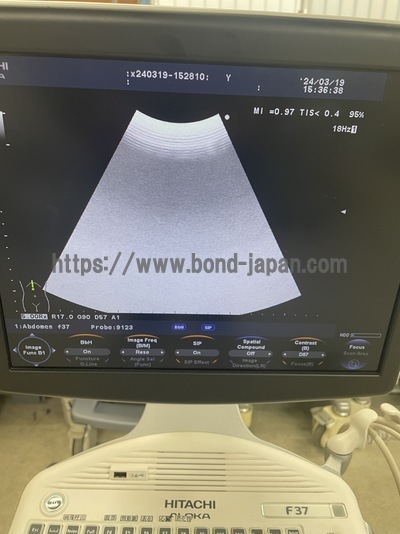 Color Doppler&nbsp;|&nbsp;HITACHI&nbsp;|&nbsp;F37