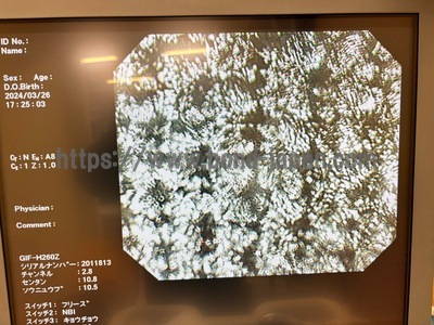 Video Gastroscope&nbsp;|&nbsp;OLYMPUS&nbsp;|&nbsp;GIF-H260Z