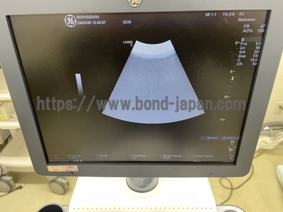 超音波診断装置/カラードプラ&nbsp;|&nbsp;GEヘルスケア・ジャパン株式会社&nbsp;|&nbsp;LOGIQ V5の写真
