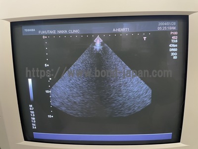 Color Doppler&nbsp;|&nbsp;CANON&nbsp;|&nbsp;SSA-550A Nemio20