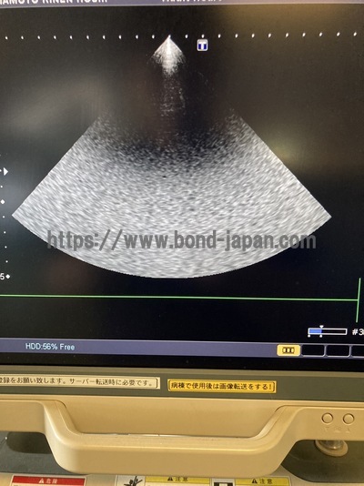 Color Doppler&nbsp;|&nbsp;CANON&nbsp;|&nbsp;SSA-660A Xario