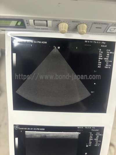 Color Doppler&nbsp;|&nbsp;GE&nbsp;|&nbsp;LOGIQ P5