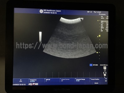Color Doppler&nbsp;|&nbsp;GE&nbsp;|&nbsp;LOGIQ V5 Expert