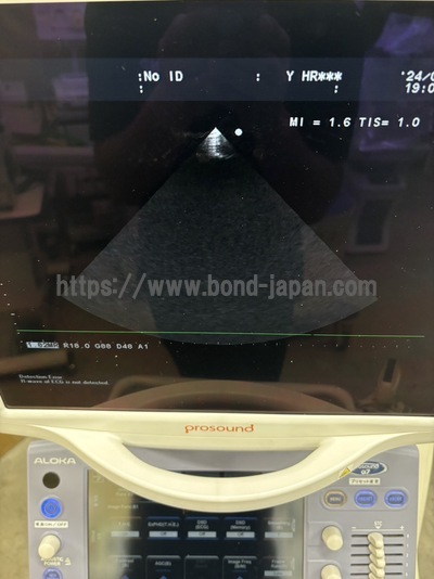 Color Doppler&nbsp;|&nbsp;HITACHI&nbsp;|&nbsp;Alpha 7