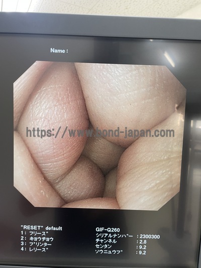 Video Gastroscope&nbsp;|&nbsp;OLYMPUS&nbsp;|&nbsp;GIF-Q260