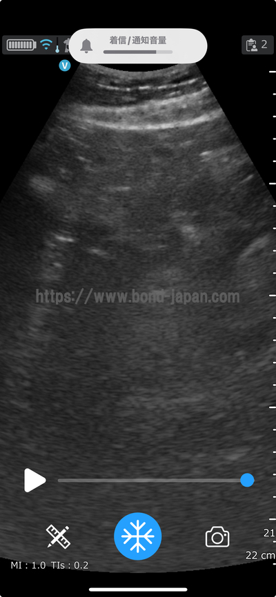 汎用超音波画像診断装置&nbsp;|&nbsp;GEヘルスケア・ジャパン株式会社&nbsp;|&nbsp;Vscan Air CLの写真