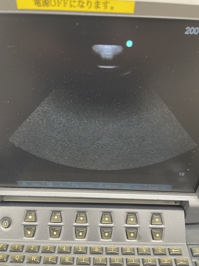 Color Doppler&nbsp;|&nbsp;SonoSite&nbsp;|&nbsp;M-Turbo