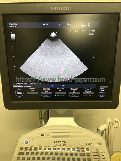 Color Doppler&nbsp;|&nbsp;HITACHI&nbsp;|&nbsp;F37