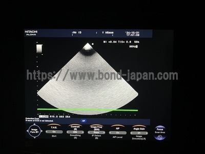 Color Doppler&nbsp;|&nbsp;HITACHI&nbsp;|&nbsp;F37