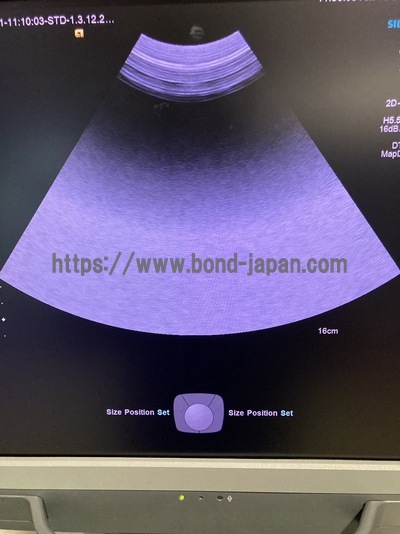 Ultrasound&nbsp;|&nbsp;SIEMENS&nbsp;|&nbsp;Acuson S1000 HELX