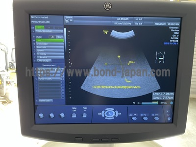 Ultrasound&nbsp;|&nbsp;GE&nbsp;|&nbsp;Voluson P8 BT18