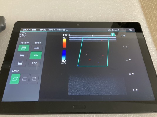 Portable Ultrasound&nbsp;|&nbsp;FUJIFILM&nbsp;|&nbsp;iViz air Linear