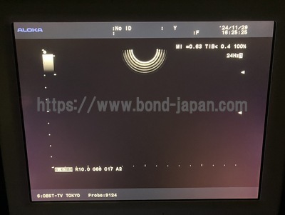 Color Doppler&nbsp;|&nbsp;HITACHI&nbsp;|&nbsp;Prosound α6