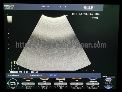 Color Doppler&nbsp;|&nbsp;HITACHI&nbsp;|&nbsp;F37