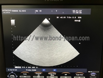 Color Doppler&nbsp;|&nbsp;HITACHI&nbsp;|&nbsp;F37