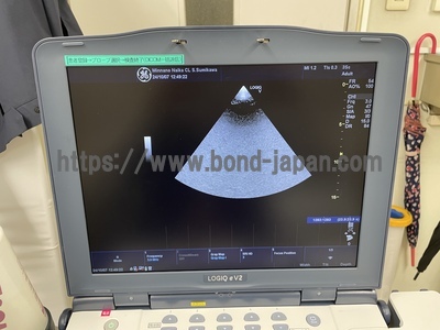 Color Doppler&nbsp;|&nbsp;GE&nbsp;|&nbsp;LOGIQ e V2